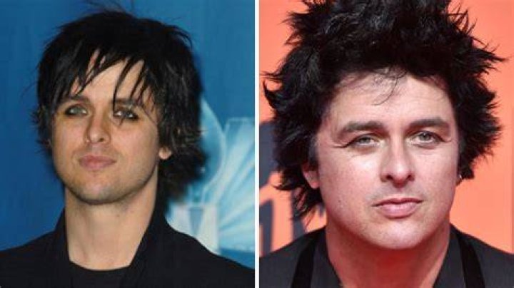 billie joe plastic surgery