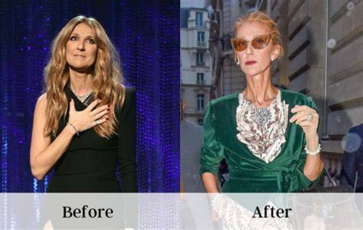 celine dion weight loss