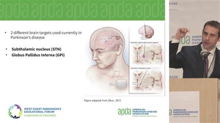 Dr. Ian Bledsoe, MD – San Francisco, CA