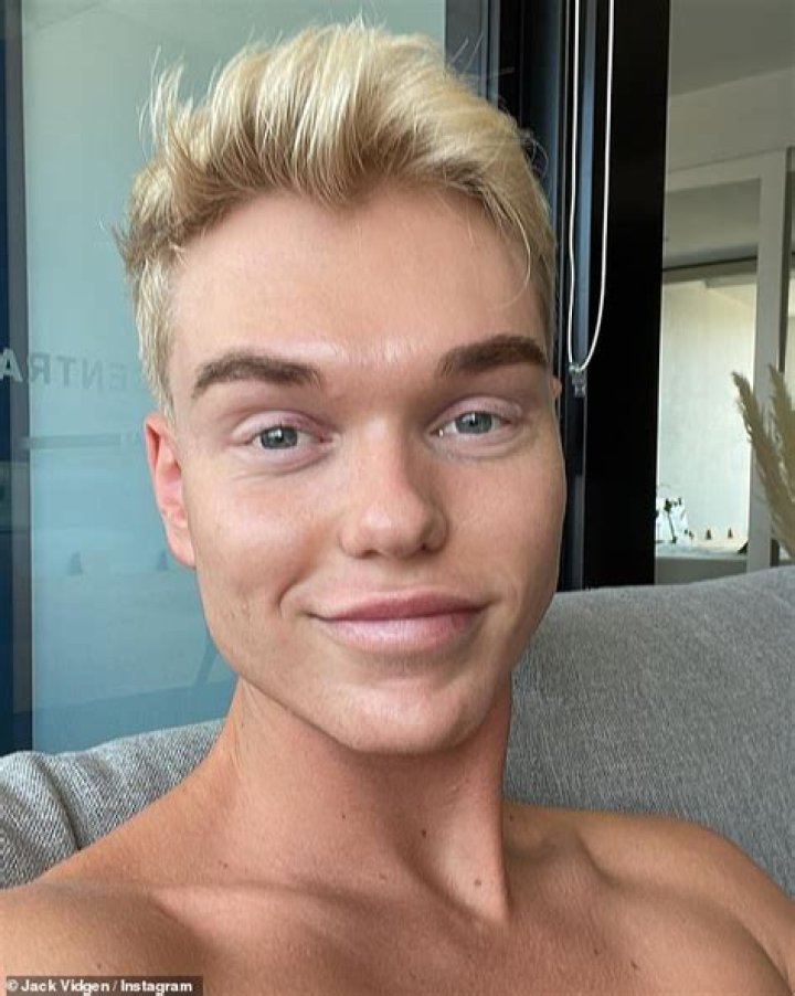 Jack Vidgen net worth, age, height, gay, brain tumor, Instagram