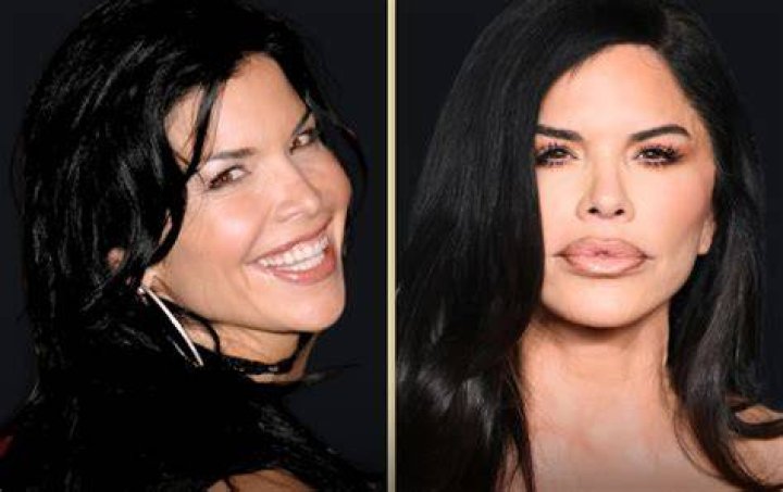 lauren sanchez plastic surgery