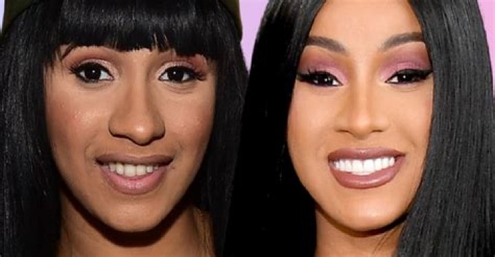 Some Cardi B Fans Blame Plastic Surgery For Her Recent Wardrobe Problems On Stage