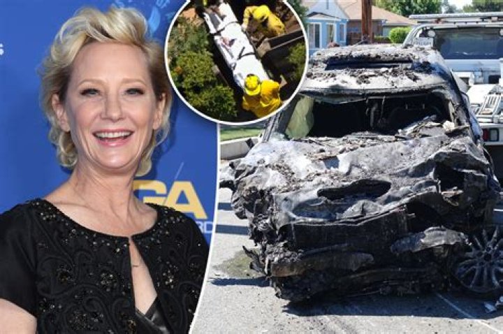 
Why Is Anne Heche Having A Mental Health Breakdown? Details About Her Arrest And Accident 